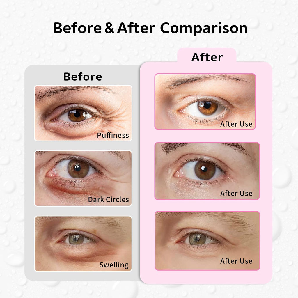 4PCS Gel Eye Ice Pack Set Reusable, Cold and Hot Compress for Eyes, Ice Pack for Eyes, Cooling Eye Pads for Eye Strain, Swelling, Redness, Dark Circles, Puffy Eyes, and Eye Recovery Surgery.