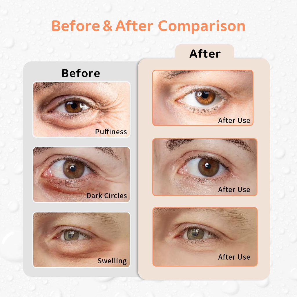 4PCS Gel Eye Ice Pack Set Reusable, Cold and Hot Compress for Eyes, Ice Pack for Eyes, Cooling Eye Pads for Eye Strain, Swelling, Redness, Dark Circles, Puffy Eyes, and Eye Recovery Surgery.