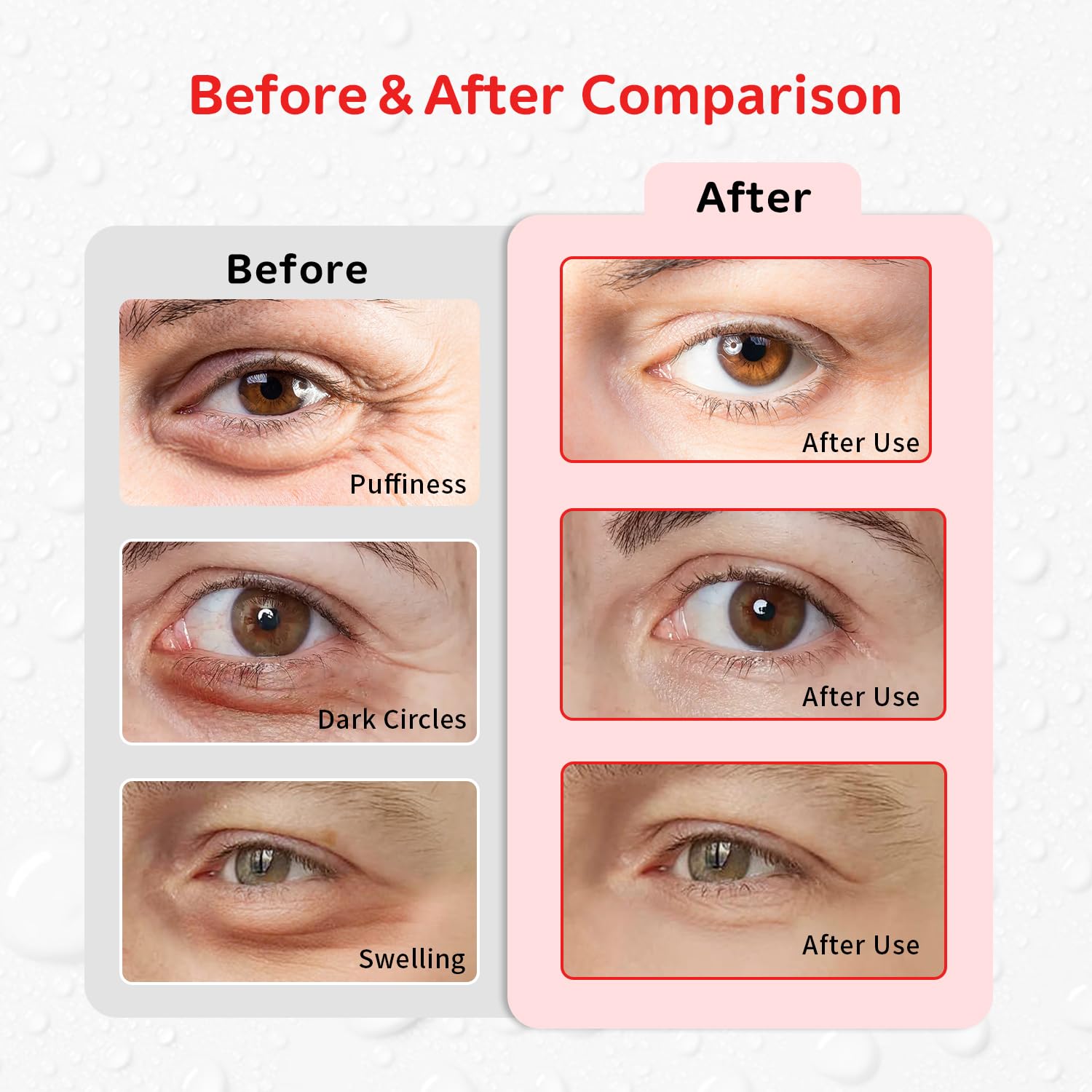4PCS Gel Eye Ice Pack Set Reusable, Cold and Hot Compress for Eyes, Ice Pack for Eyes, Cooling Eye Pads for Eye Strain, Swelling, Redness, Dark Circles, Puffy Eyes, and Eye Recovery Surgery.