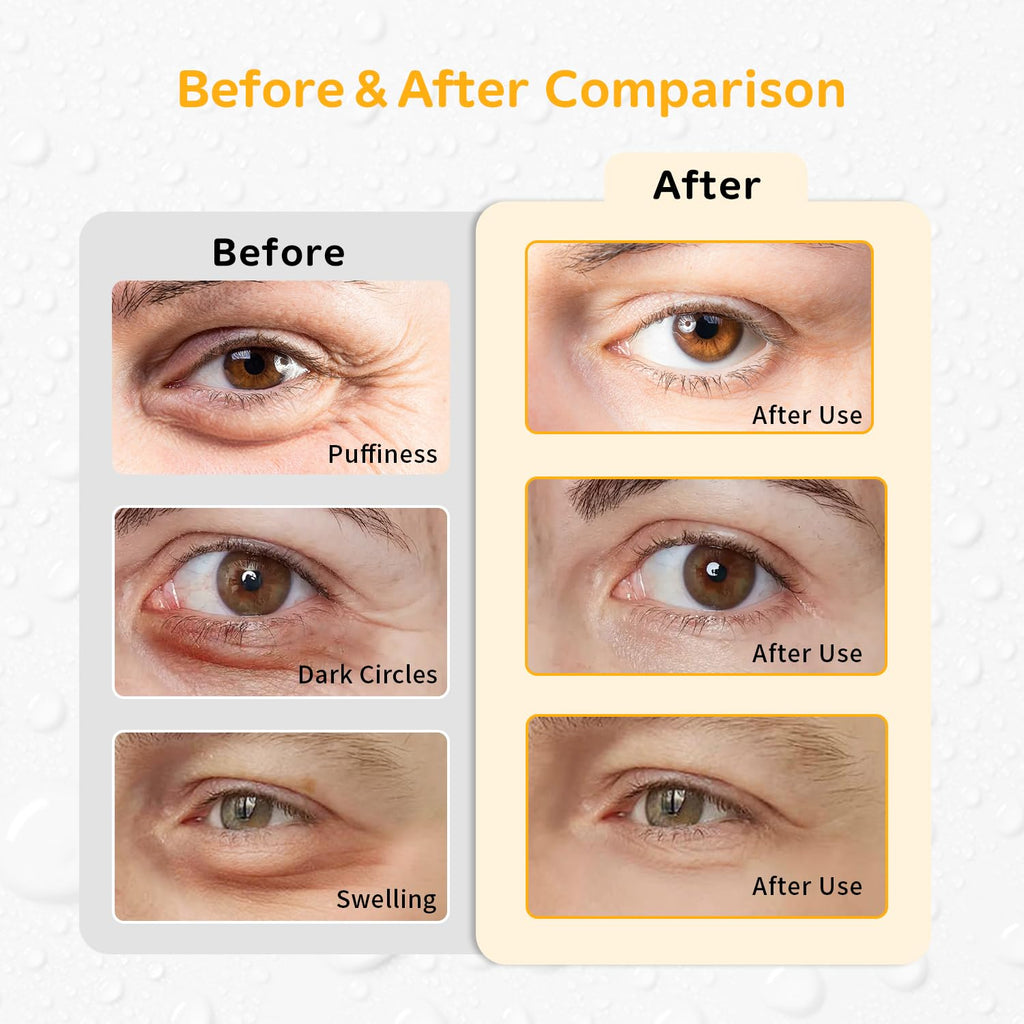 4PCS Gel Eye Ice Pack Set Reusable, Cold and Hot Compress for Eyes, Ice Pack for Eyes, Cooling Eye Pads for Eye Strain, Swelling, Redness, Dark Circles, Puffy Eyes, and Eye Recovery Surgery.