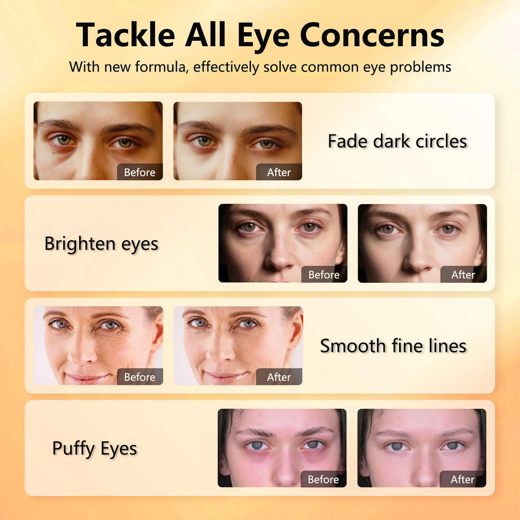 Vitamin C & Caffeine Under Eye Patches for Men & Women 30 Pairs | Eye Masks for Dark Circles, Fine Lines and Puffiness, with Niacinamide Hydra-Gel Collagen, Skincare for Face