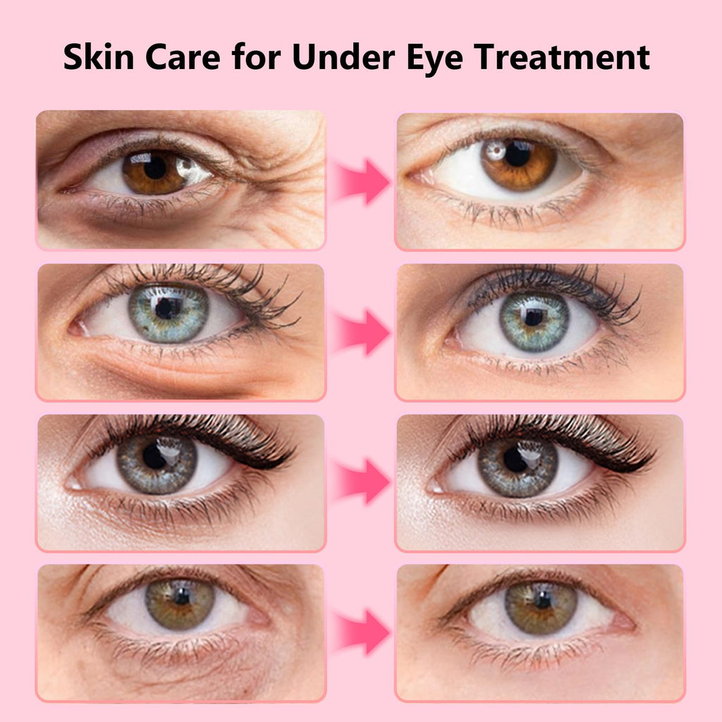Adofect Hydrogel Caffeine Under Eye Masks, Collagen Eye Patches for Dark Circles Puffy Eyes Under Eye Bags, Deep Hydration Eye Gels for All Skin Types, Skin Care Gifts (Pink, 30 Pairs)
