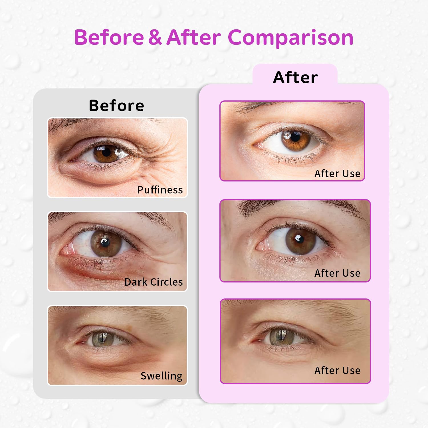 4PCS Gel Eye Ice Pack Set Reusable, Cold and Hot Compress for Eyes, Ice Pack for Eyes, Cooling Eye Pads for Eye Strain, Swelling, Redness, Dark Circles, Puffy Eyes, and Eye Recovery Surgery.