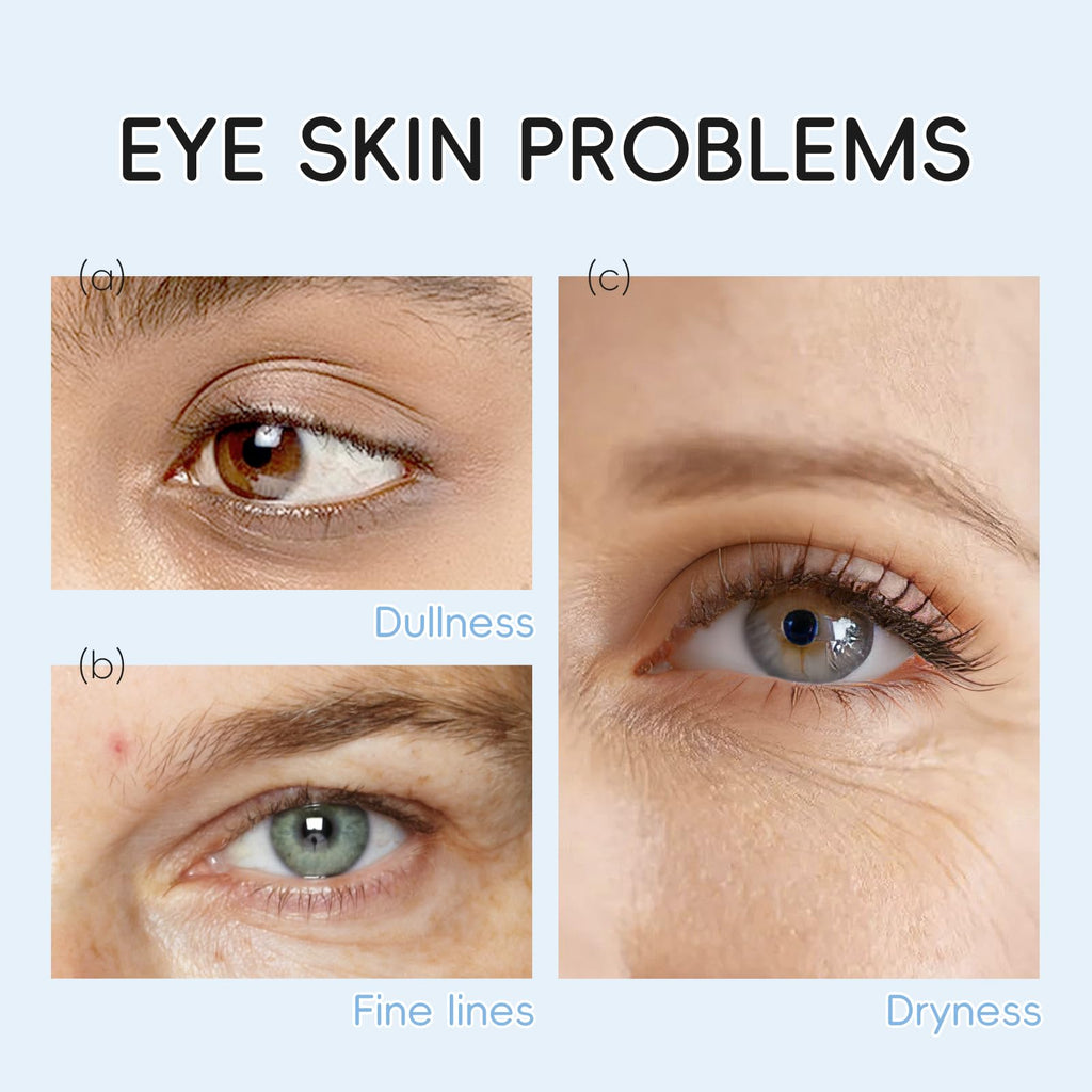 AKARY Eye Patches Rose Hydra-Gel Eye Mask Sheet Lady Skin Care Pad Remove Fine Lines Smooth Repair the Eyes Skin, Under Eye Gel for Moisturizing and Relieving, Firm the Look of the Eye Area