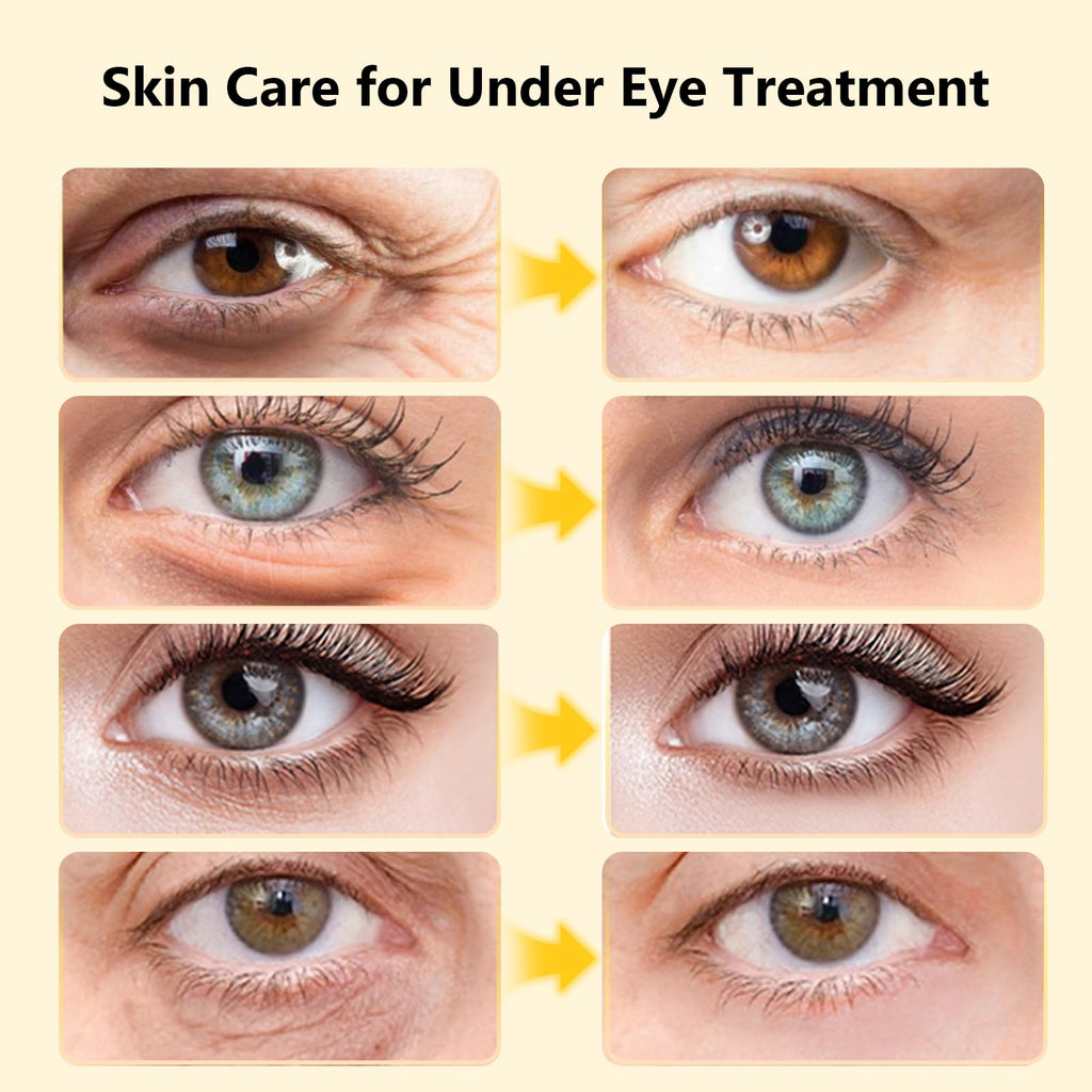 Adofect Hydrogel Caffeine Under Eye Masks, Collagen Eye Patches for Dark Circles Puffy Eyes Under Eye Bags, Deep Hydration Eye Gels for All Skin Types, Skin Care Gifts (Pink, 30 Pairs)