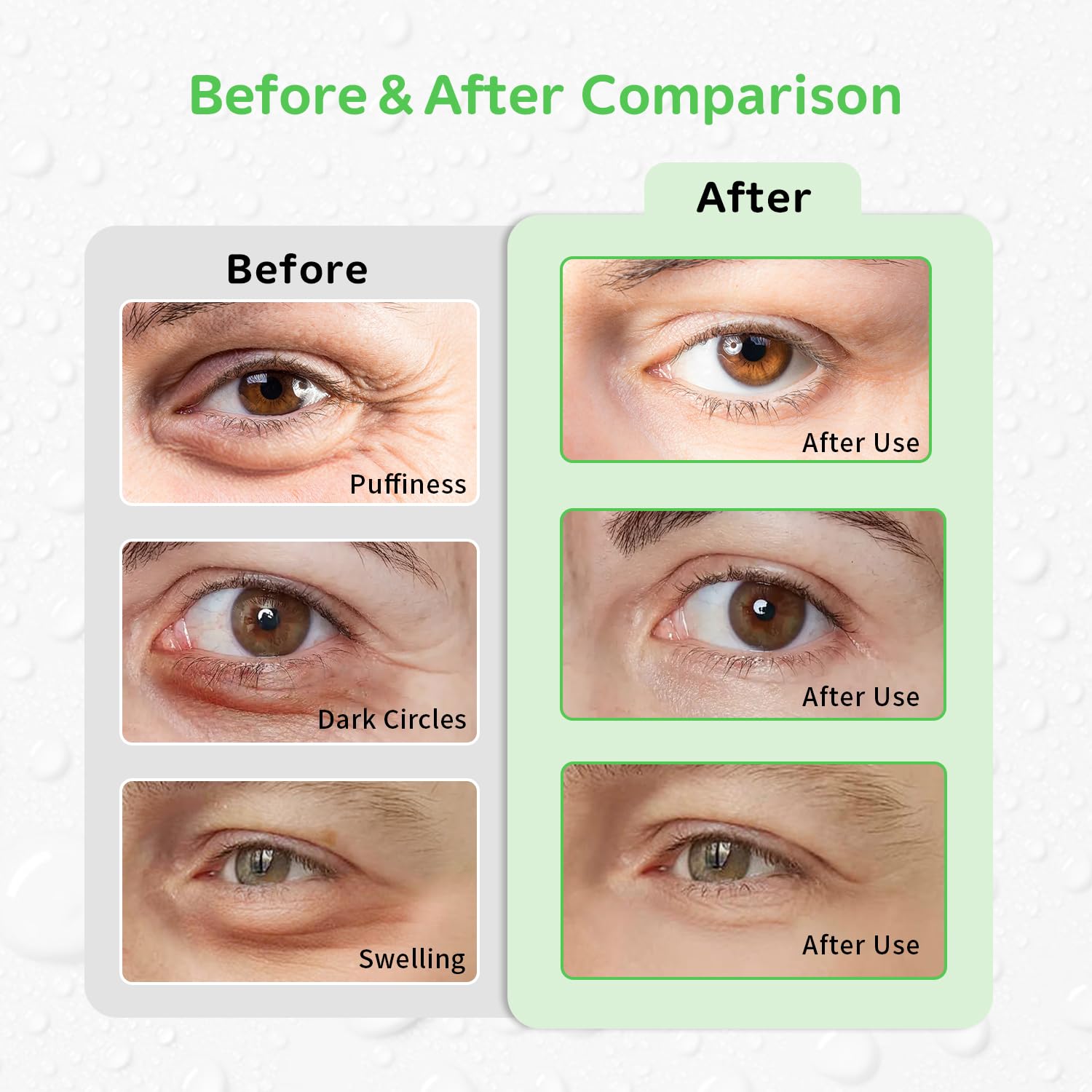 4PCS Gel Eye Ice Pack Set Reusable, Cold and Hot Compress for Eyes, Ice Pack for Eyes, Cooling Eye Pads for Eye Strain, Swelling, Redness, Dark Circles, Puffy Eyes, and Eye Recovery Surgery.