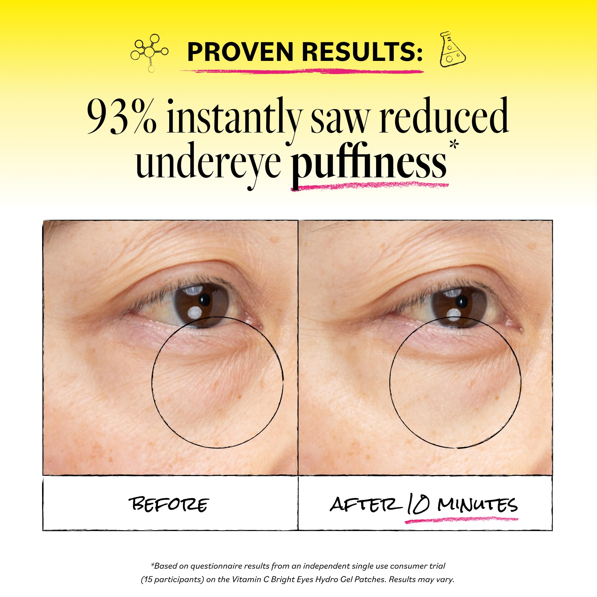 Derma E Vitamin C Bright Eyes Hydro Gel Under Eye Patches for Dark Circles (60 Ct, 30 Pairs) Allantoin, Caffeine & Vitamin B3, Eye Patches for Fine Lines, Wrinkles, Dark Circles & Puffy Eyes
