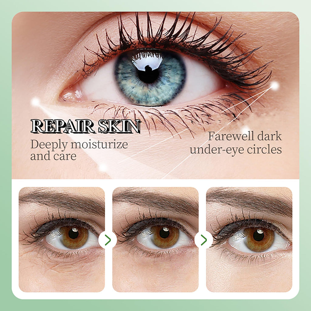 AKARY Eye Patches Rose Hydra-Gel Eye Mask Sheet Lady Skin Care Pad Remove Fine Lines Smooth Repair the Eyes Skin, Under Eye Gel for Moisturizing and Relieving, Firm the Look of the Eye Area